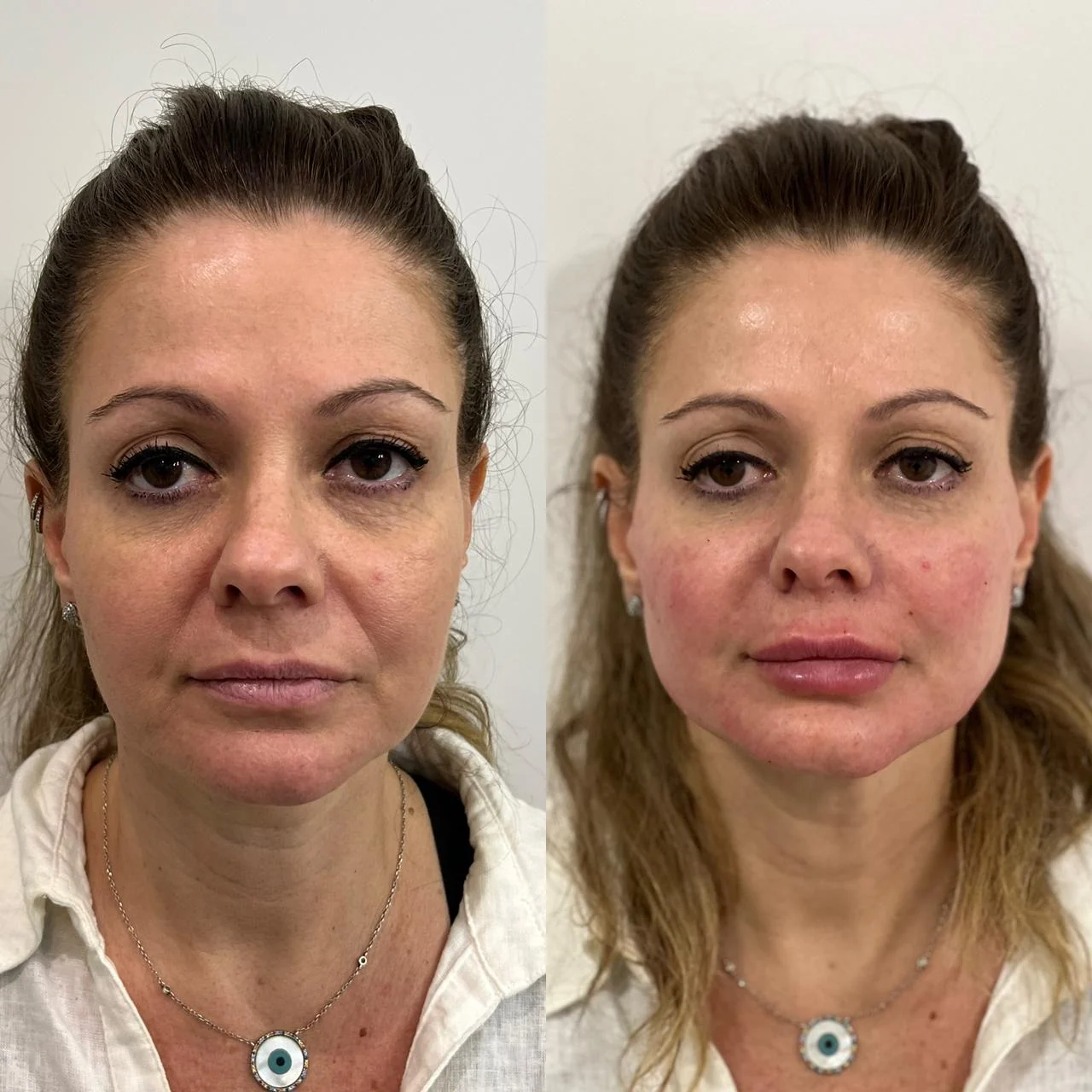 Registro clínico facial comparativo 01