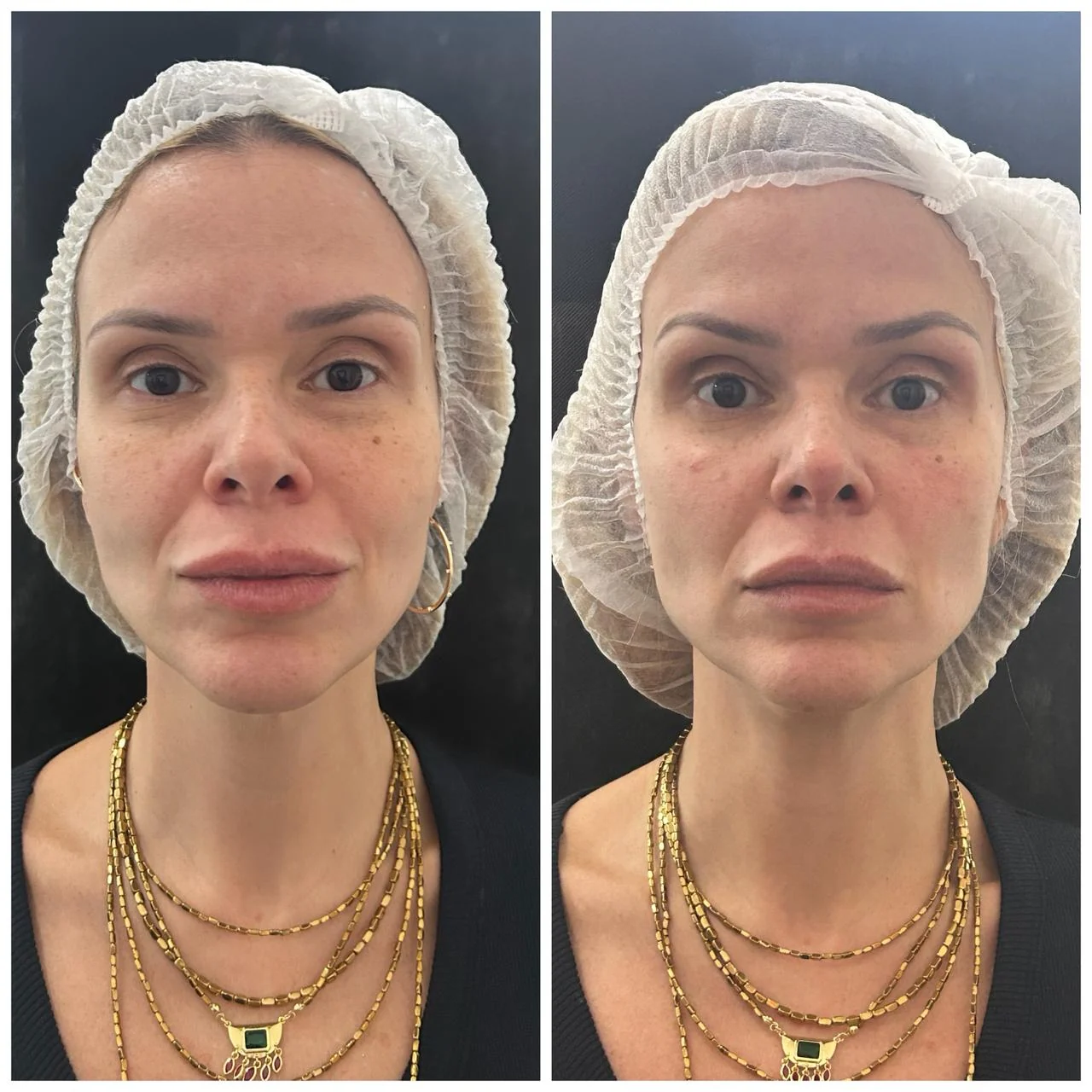 Registro clínico facial comparativo 02